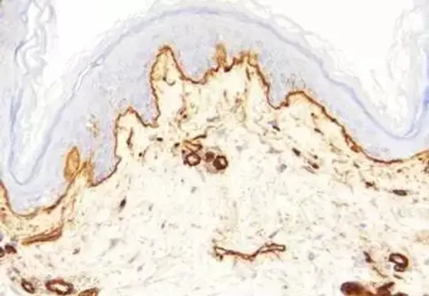 PKA inhibitor fragment (6-22) amide - 10mg